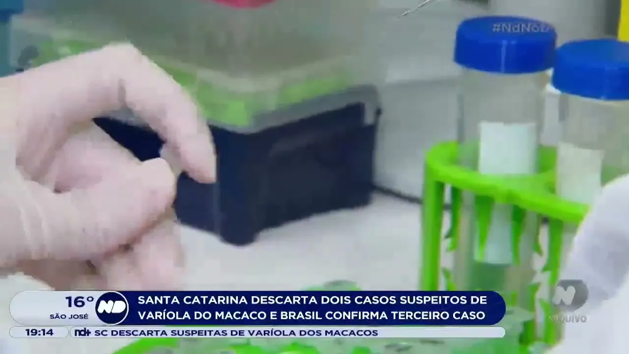 Casos suspeitos de varíola do macaco em Santa Catarina foram descartados