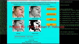 Acne Disease Classification Using Image Processing Python Project With Source Code