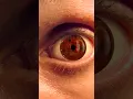 Download Lagu Super Realistic Mangekyou Sharingan in REAL LIFE (Uchiha Itachi): Animated Iris - No 2D Overlay