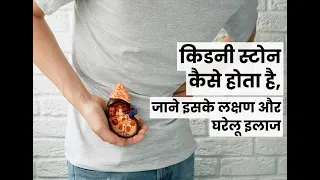 किडनी स्टोन (पथरी) को गलाकर बाहर निकालने के उपाय | Kidney Stone Causes & Home Remedies 💯 Working