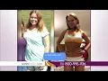 Sono Bello Laser Liposuction Dr Andrew Ordon The Doctors Sono Bello Reviews