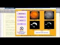 Matlab Project Diabetic Retinopathy Detection using cnn full Source Code