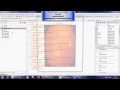 Segmentation of Blood Vessels and Optic Disc in Retinal Images