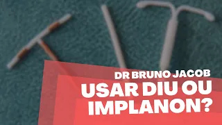 DIU OU IMPLANON, QUAL O MELHOR? - DR BRUNO JACOB