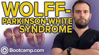 Wolff Parkinson White Syndrome HIGH YIELD CARDIOLOGY USMLE STEP 1 