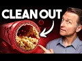 Download Lagu The #1 Best Meal to Reverse Heart Disease \u0026 Type 2 Diabetes