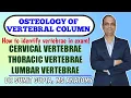Osteology of Vertebrae vertebral column cervical thoracic and lumbar vertebrae