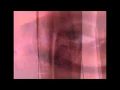 impoesible - resilienciadores - ΓΊtero insectado \u0026 lander \u0026 mr pig