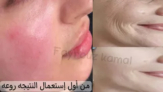 Whitening Forever Stronger Bleaching Skin Quickly God Then God Clear Skin White Catlag 