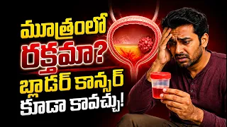 బ్లాడర్ క్యాన్సర్ లక్షణాలు మరియు చికిత్స విధానాలు | డా. యశస్వి రెడ్డి