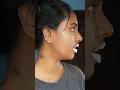 Lagu colgate പണി തന്നു🥵 | Brownish_girl_ | #hack #colgate #lips #shorts #short #viral