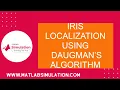Iris Localization Using Daugman s Algorithm Matlab Projects Iris Recognition using Matlab