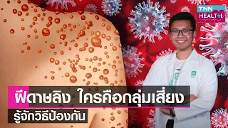 มีวิธีป้องกันโรคฝีดาดลิงอย่างไรบ้าง