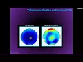 Intro to connectivity volume conduction and time - vs trial-based connectivity