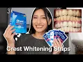 I TRIED THE CREST 3D WHITESTRIPS FOR 14 DAYS Effective Before After pictures