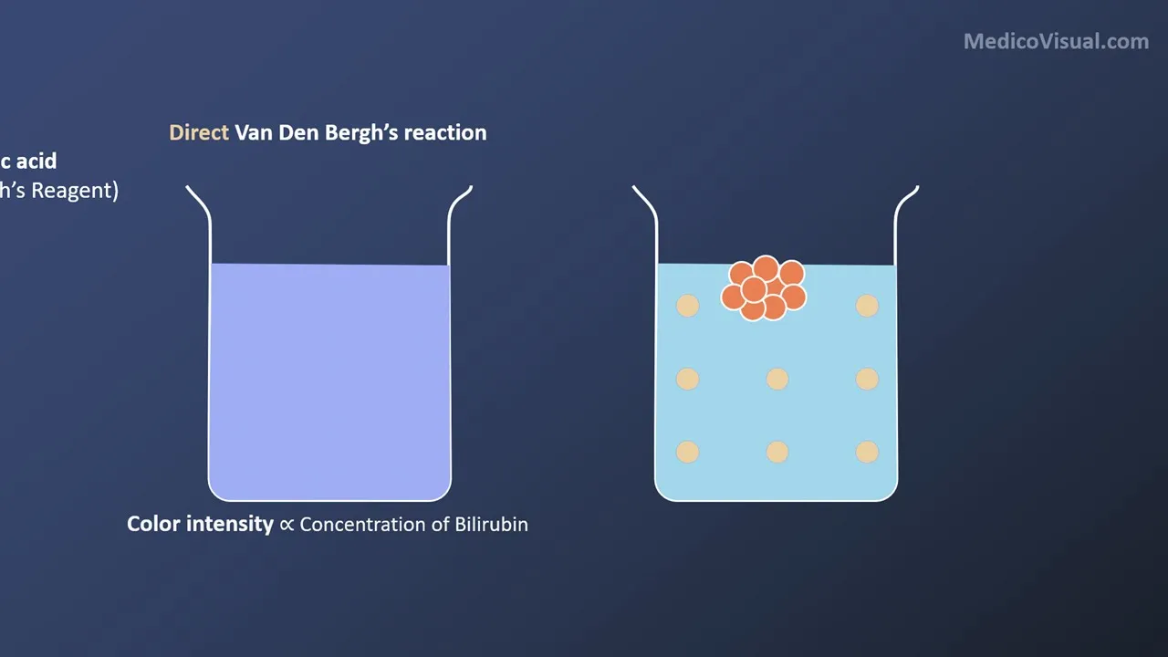 Van Den Bergh's Reaction - Direct vs Indirect Bilirubin - Bilirubin metabolism