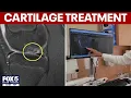 New treatment for cartilage problems