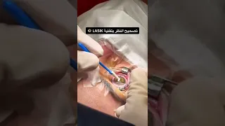 تقنية الليزك لتصحيح النظر من أكثر العمليات انتشارا 