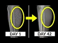 This Is THE BEST PROTOCOL To Eliminate Parasites Naturally