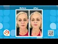 Glo Medspa can help you look years younger without surgery with facial Threading