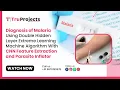 Diagnosis of Malaria Using Double Hidden Layer Extreme Learning Machine Algorithm With CNN Feature E