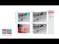 SpotMap v3 0 HCP Antibody Coverage Analysis 2D Gel WB Analysis Software TotalLab