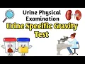Urine Specific Gravity Test Urinalysis Procedure Normal Value Causes Clinical Importance