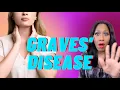 What Are SIGNS OF GRAVES DISEASE Hyperthyroidism A Doctor Explains
