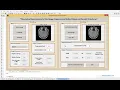 MATLAB code of Improvement of Medical Image Compression using different wavelet transforms