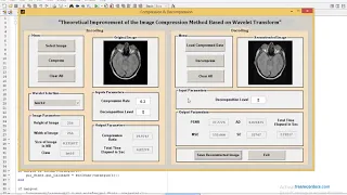 MATLAB code of Improvement of Medical Image Compression using different wavelet transforms