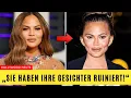 Lagu 7 Hollywood-Stars, Deren Gesicht Durch Buccal Fat Removal Entstellt Wurde | Vorher \u0026 Nachher 2025