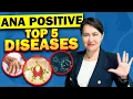 Top 5 Diseases with A Positive ANA Antinuclear Antibodies Test
