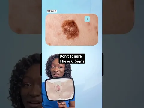 Don’t Ignore These 6 Signs on Vulva | Doctor Explains