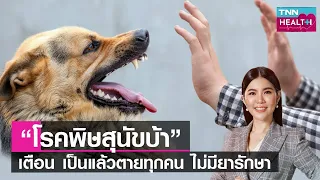 โรคพิษสุนัขบ้าเกิดจากเชื้ออะไร และมีลักษณะอย่างไรในร่างกาย