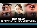 Download Lagu 4 Penyebab Mata Merah dan Cara Mencegahnya | Hidup Sehat tvOne