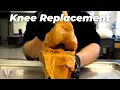 Is KNEE REPLACEMENT the MOST PAINFUL surgery ever