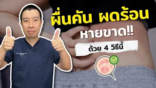 ผื่นคันที่ขึ้นเรื่อยๆตามตัว หน้า แขน ขา และหลัง มีสาเหตุจากอะไรบ้าง?