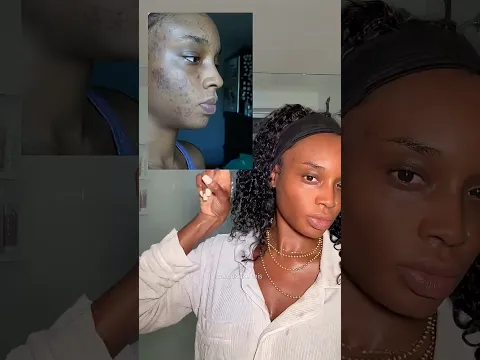 DARKSPOTS TAKING OVER!!!? Skincare Routine 🫧🧴💕