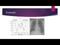 Histogram Analysis Vid