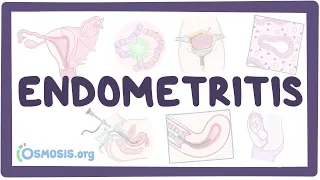 Endometritis - an Osmosis