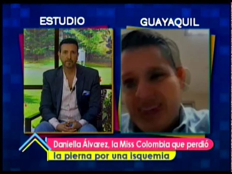 Daniella Álvarez, la Miss Colombia que perdió la pierna por una isquemia