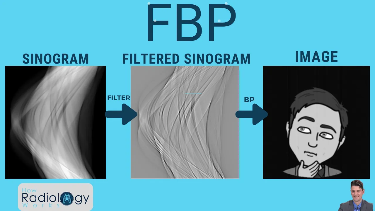 Filtered Backprojection in CT: A Guide for Technologists