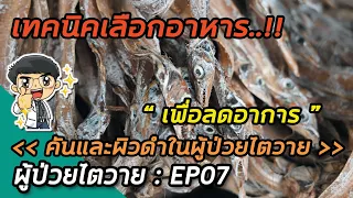 ผู้ป่วยฟอกไตสามารถทานอาหารอะไรได้บ้างโดยไม่ต้องกังวลเรื่องฟอสฟอรัส