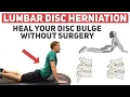 How to Heal Your Disc Herniation Without Surgery