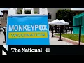 Sorting fact from fiction about how monkeypox spreads