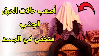 أصعب حالات الحرق لجني متخفي في الجسد دندنها