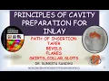 Principles of Inlay cavity preparation inlay cavity preparation bevels in inlay