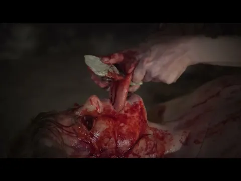 ROMANCE POST-MORTEM - TEASER - EXTREME!!!