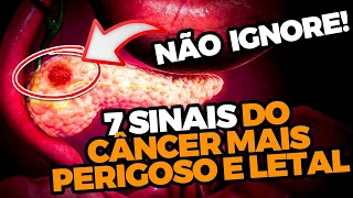 7 Sinais de Câncer no Pâncreas Que Você Não Pode Ignorar