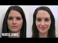 Before and After Facial Cupping - Nurse Jamie on E News